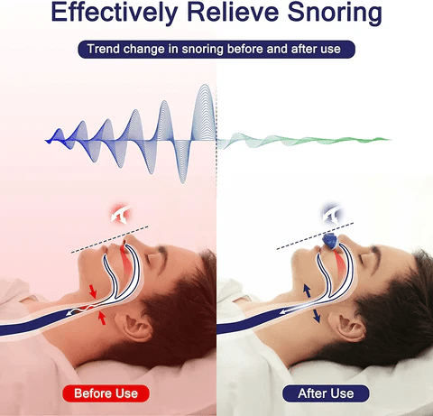 Compact Micro CPAP Travel Machine – Portable Sleep Apnea & Snoring Relief Device - Monsta Online