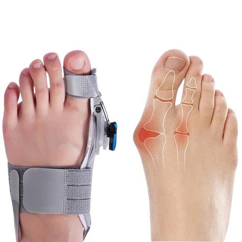 Adjustable Toe Spacer – Silicone Foot Alignment, Bunion Relief & Universal Fit - Monsta Online