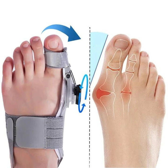 Adjustable Toe Spacer – Silicone Foot Alignment, Bunion Relief & Universal Fit - Monsta Online
