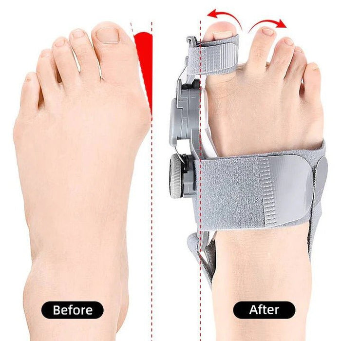 Adjustable Toe Spacer – Silicone Foot Alignment, Bunion Relief & Universal Fit - Monsta Online